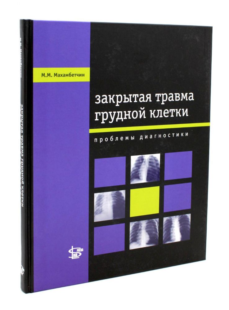 Закрытая травма грудной клетки: проблемы диагностики