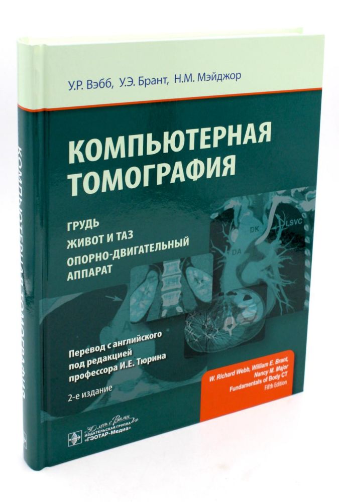 Компьютерная томография: грудь, живот и таз, опорно-двигательный аппарат. 2-е изд (пер.)