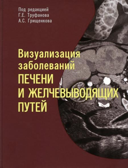 Визуализация заболеваний печени и желчевыводящих путей: Учебное пособие