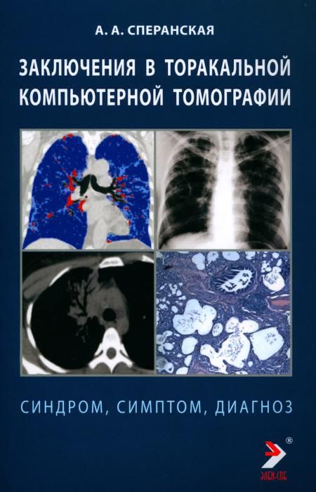 Заключение в торакальной компьютерной томографии. Симптом, синдром, диагноз