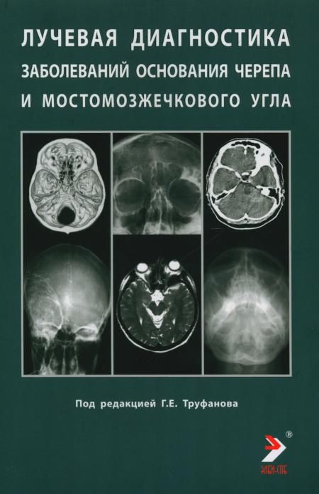 Лучевая диагностика заболеваний оснований черепа и мостмозжечкового угла: Учебное пособие