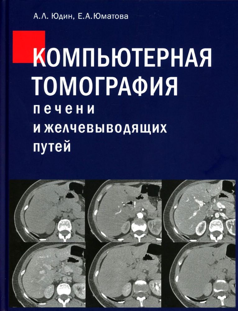 Компьютерная томография печени и желчевыводящих путей: практическое руководство