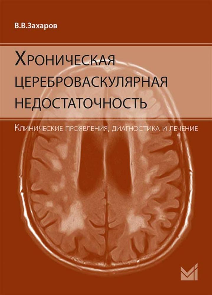 Хроническая цереброваскулярная недостаточность. 4-е изд., перераб.и доп