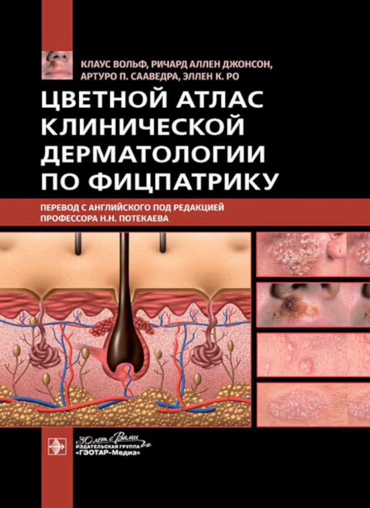 Цветной атлас клинической дерматологии по Фицпатрику