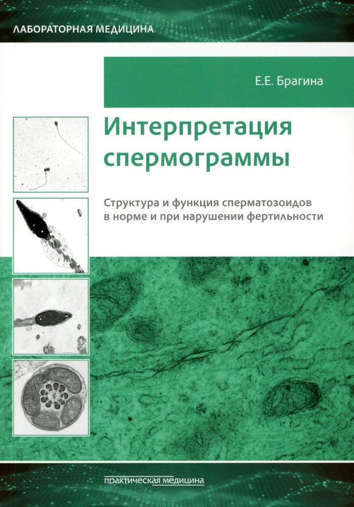 Интерпретация спермограммы. Структура и функция сперматозоидов в норме и при нарушении фертильности