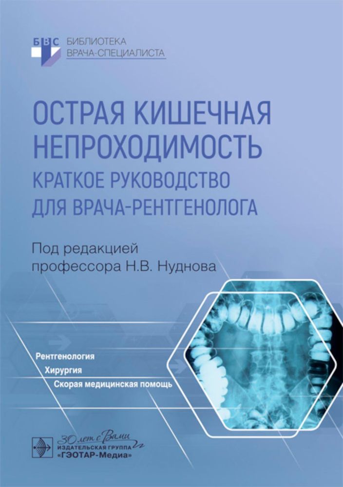 Острая кишечная непроходимость. Краткое руководство для врача-рентгенолога