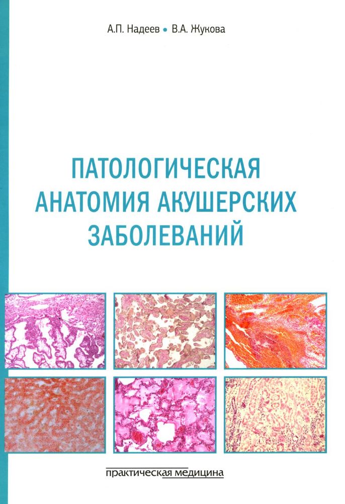 Патологическая анатомия акушерских заболеваний