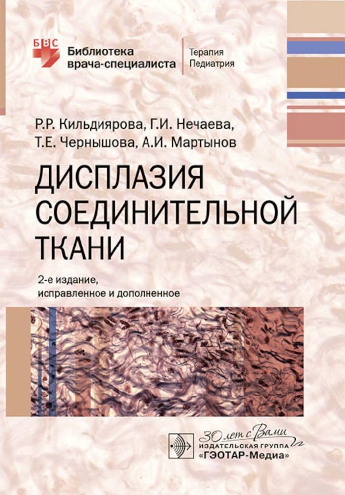 Дисплазия соединительной ткани. 2-е изд., испр. и доп