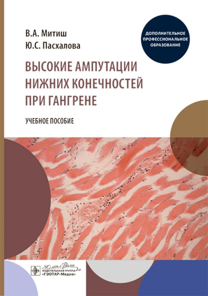 Высокие ампутации нижних конечностей при гангрене