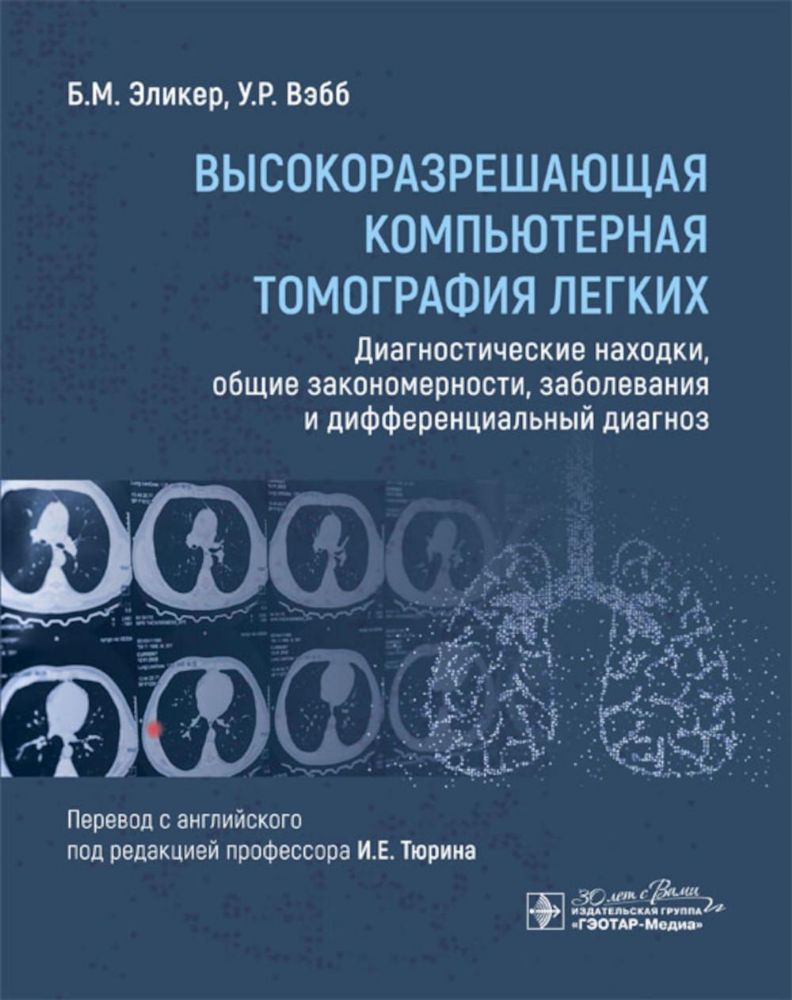 Высокоразрешающая компьютерная томография легких. Диагностические находки, общие закономерности, заболевания и дифференциальный диагноз