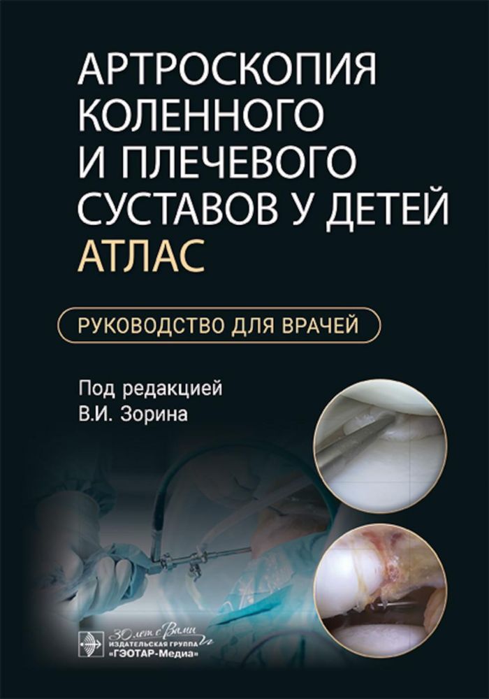 Артроскопия коленного и плечевого суставов у детей. Атлас : руководство для врачей