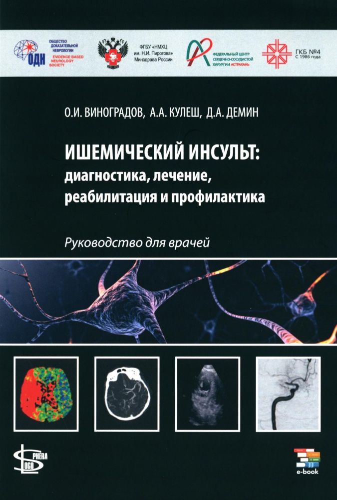 Ишемический инсульт: диагностика, лечение, реабилитация и профилактика. Руководство для врачей