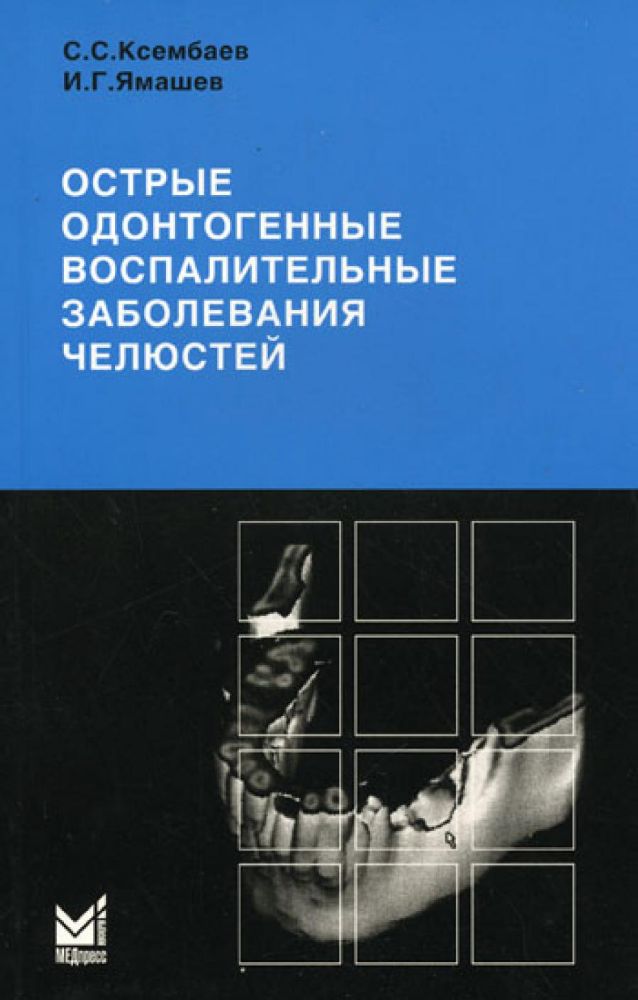 Острые одонтогенные воспалительные заболевания челюстей. Диагностика и лечение анго-и остеогенных нарушений