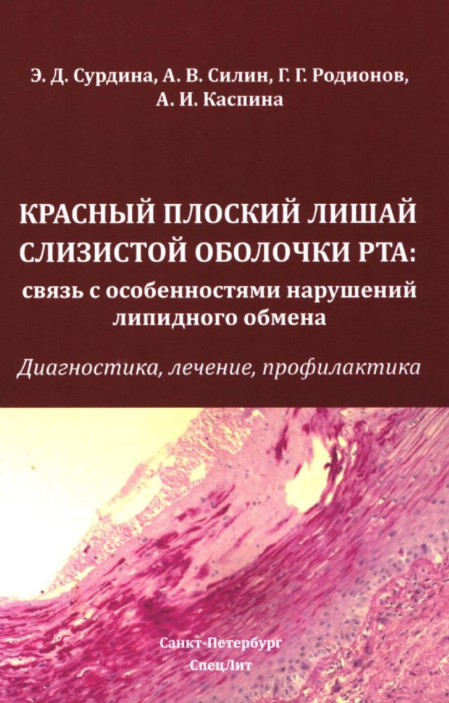 Красный плоский лишай слизистой оболочки рта: связь с особенностями нарушений липидного обмена. Диагностика, лечение, профилактика