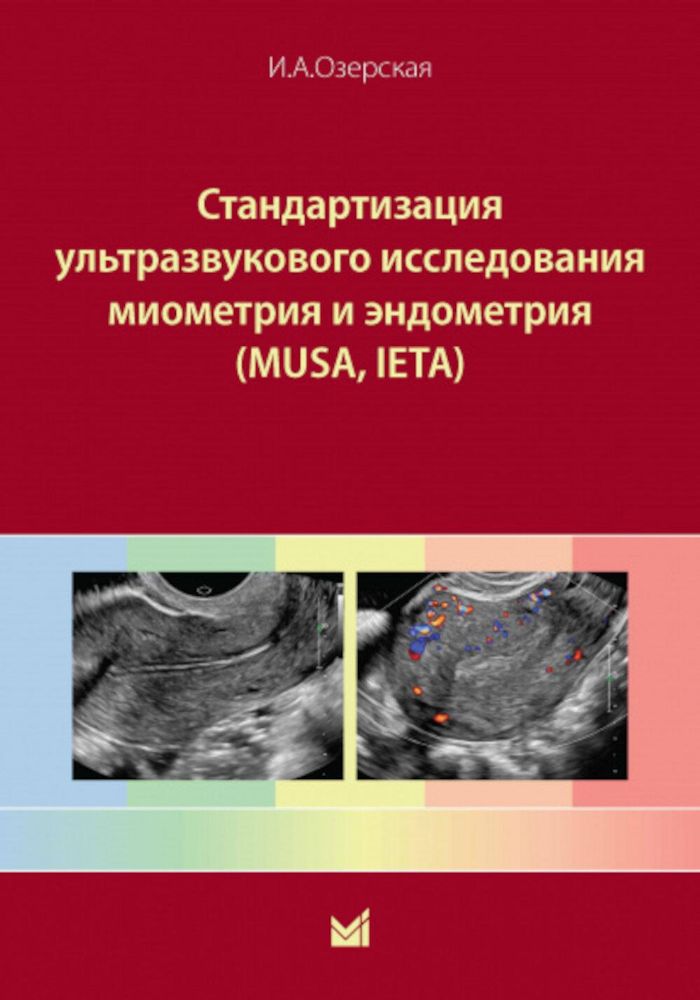 Стандартизация ультразвукового исследования миометрия и эндометрия (MUSA, IETA): Учебное пособие. 2-е изд