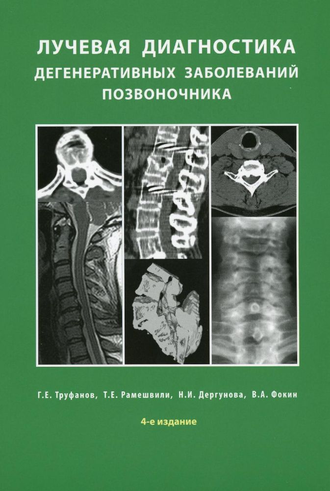 Лучевая диагностика дегенеративных заболеваний позвоночника