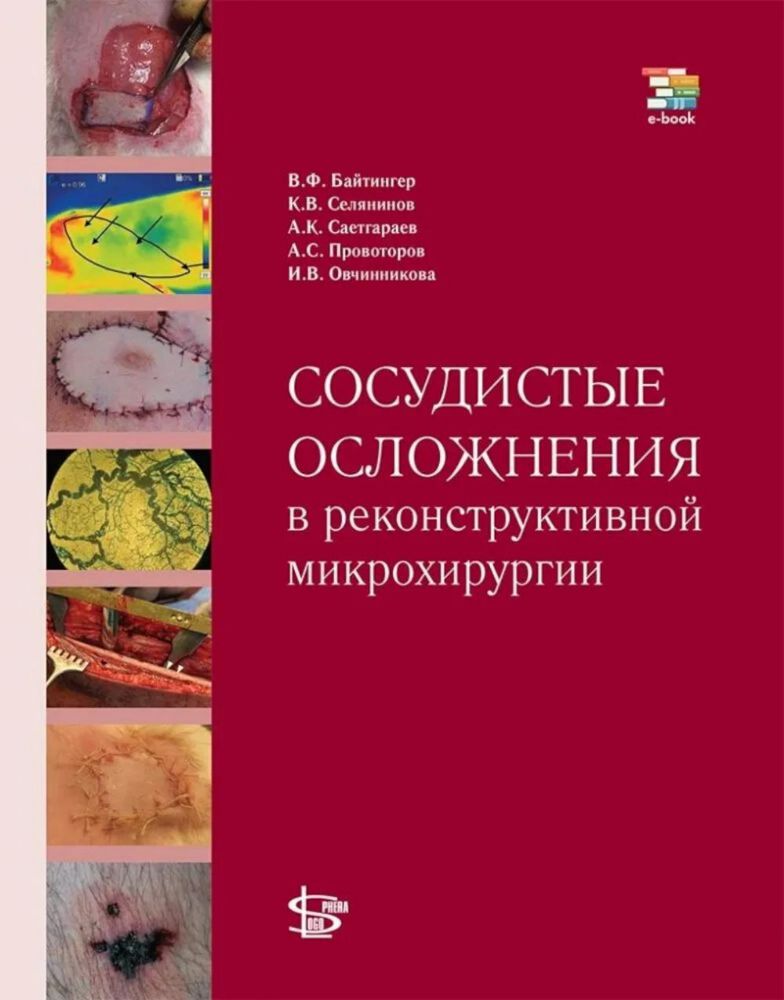 Сосудистые осложнения в реконструктивной микрохирургии