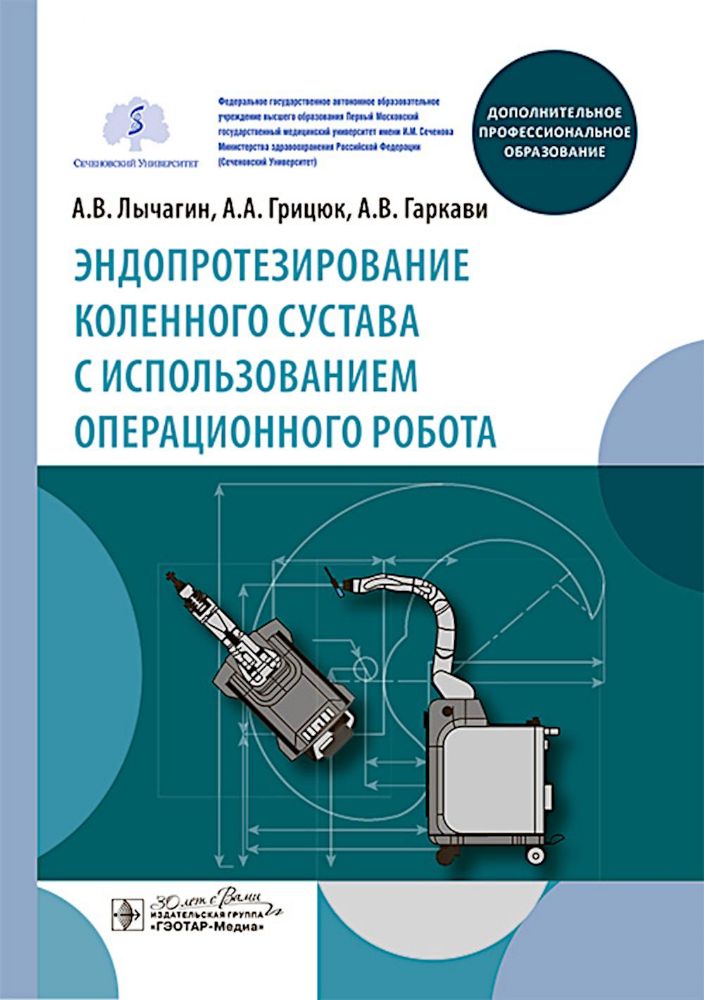 Эндопротезирование коленного сустава с использованием операционного робота: Учебное пособие