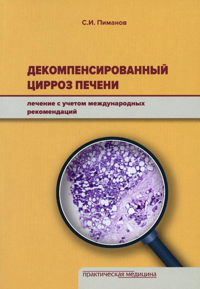 Декомпенсирован.цирроз печени.Леч. учетом межд.рек